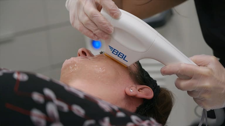 BBL Treatment | No Downtime | Dr Darren McKeown